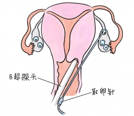 幼儿学画画，徐州捐卵宝宝学画画，学画画的好处，如何学画画