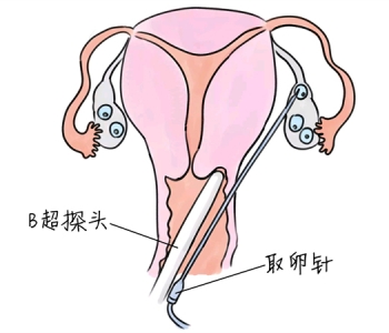 幼儿学画画，徐州捐卵宝宝学画画，学画画的好处，如何学画画